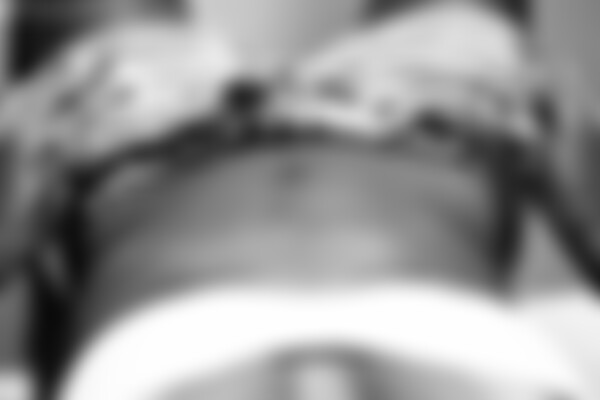 anterior